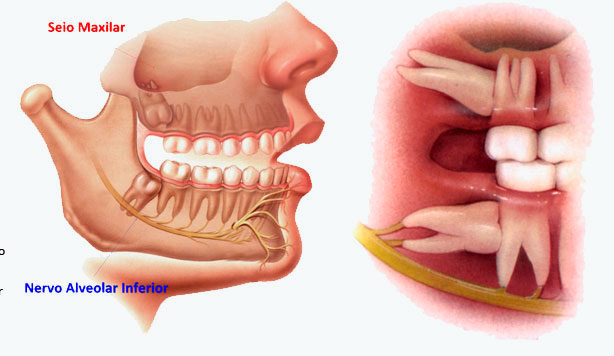 RECUO MAXILO-MANDIBULAR - CLINICA DA FACE