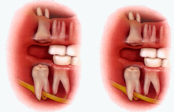 RECUO MAXILO-MANDIBULAR - CLINICA DA FACE